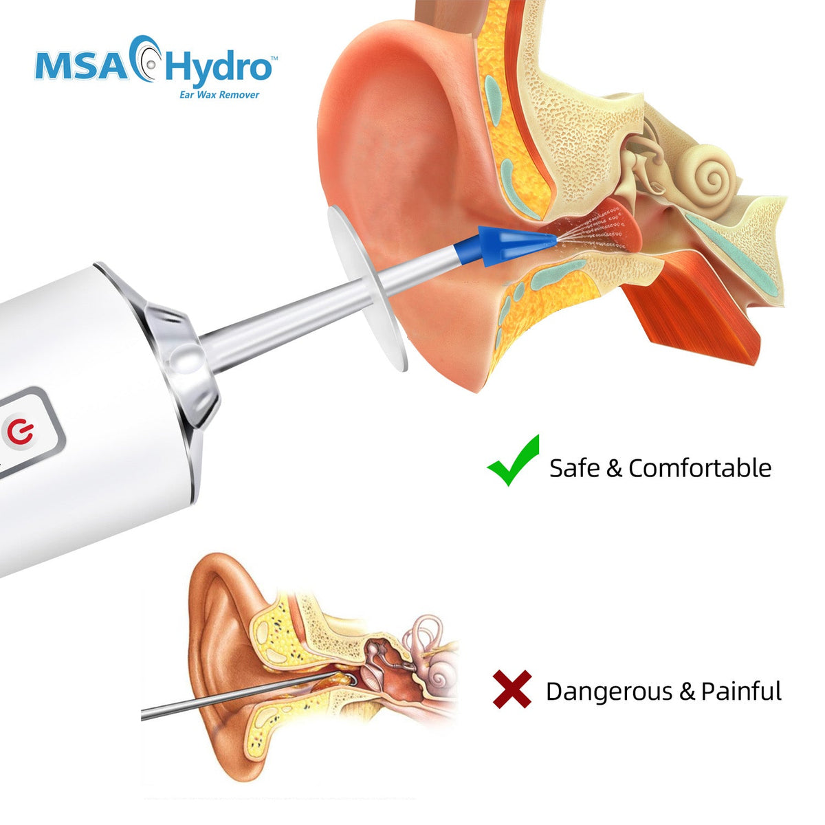 HydroClear Ear Wax Flushing Kit