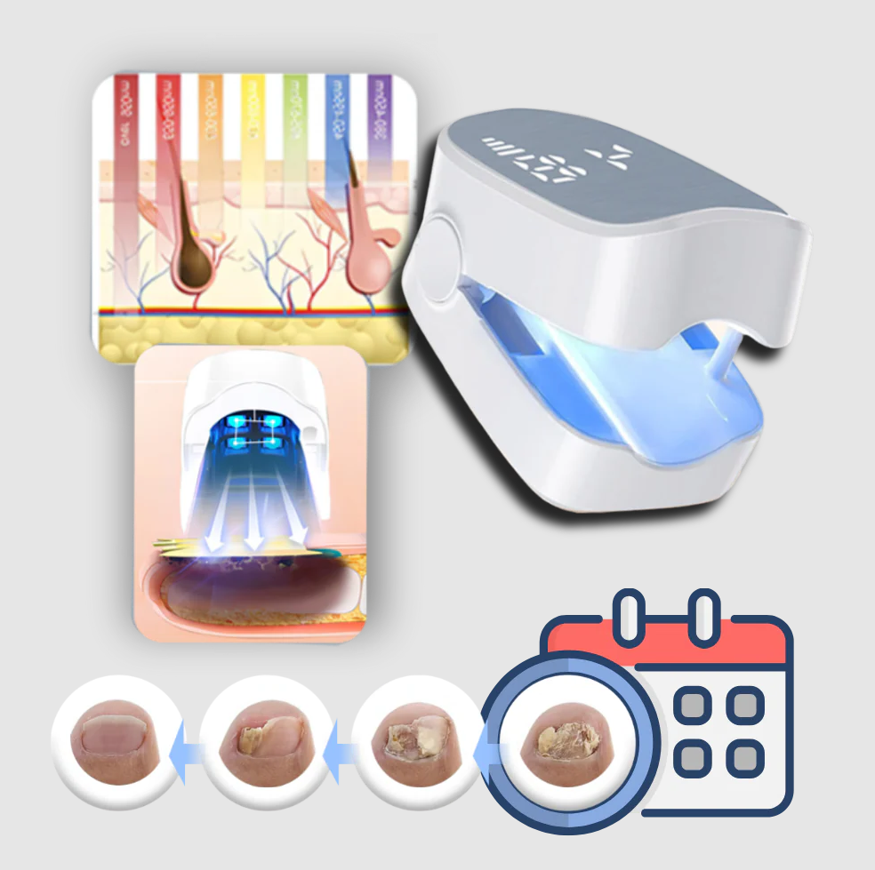 Painless Nail Fungus Laser