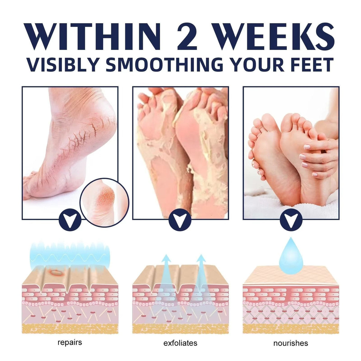 Cracked Foot Heel Treatment 3 Pack